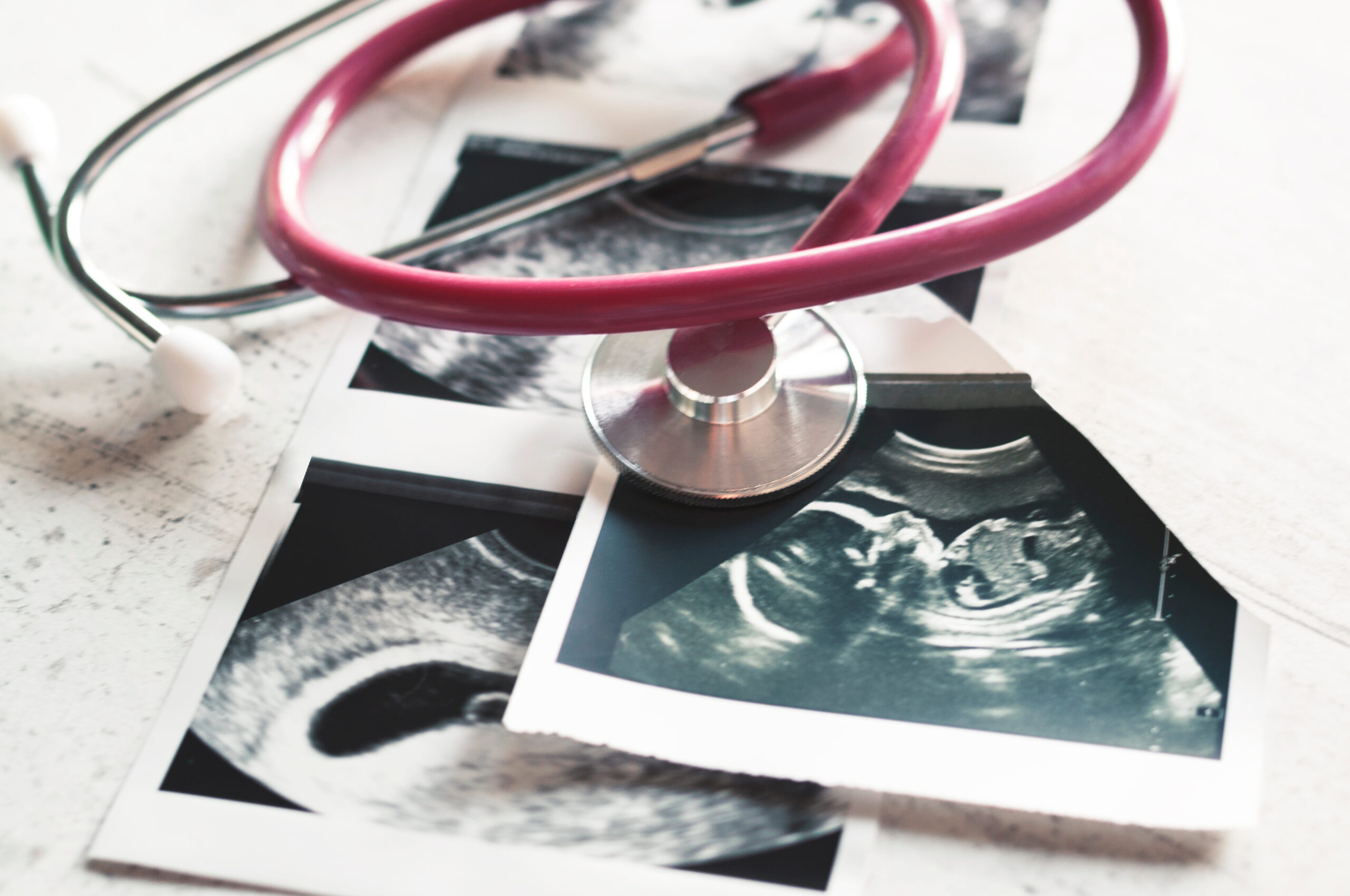 AdobeStock_232378407-scaled-2